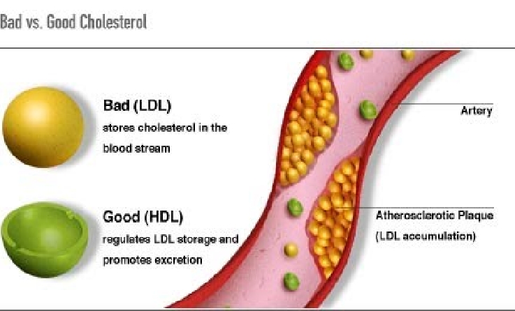 HDL & LDL